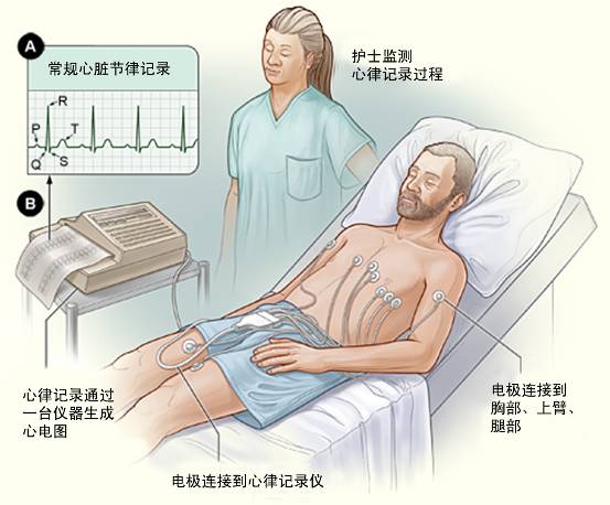 冠心病需要做哪些檢查？(圖1)